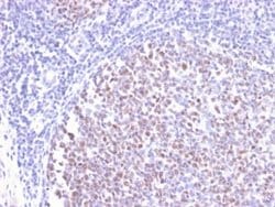 Bcl-6 Antibody (BCL6/2497R) - Azide and BSA Free, Novus Biologicals 100 &mu;g | Buy Online | Novus Biologicals | Fisher Scientific